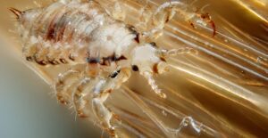 head louse