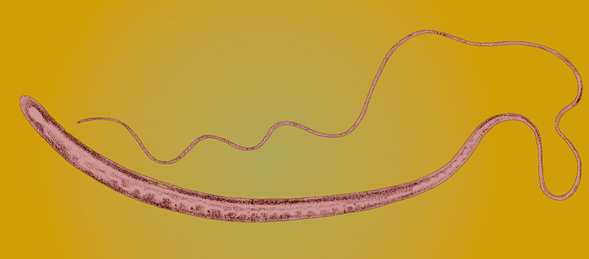 whipworm